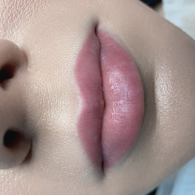 Natural-looking lips after Lip Blush treatment
